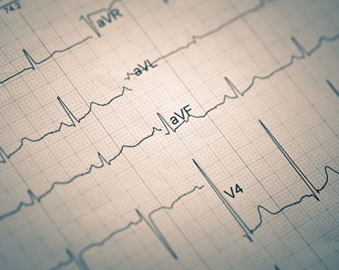 Imagen: El modelo de IA puede predecir riesgos para la salud, incluida la muerte prematura, a partir de ECG (foto cortesía de Adobe Stock)